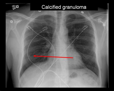 On Call Radiology - common radiology findings on call and in the Emergency Room and during the ...