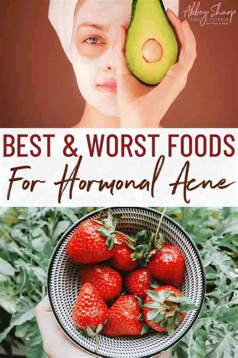 The Hormonal Acne Diet - The Best Foods for Healthy Clear Skin - Abbey ...