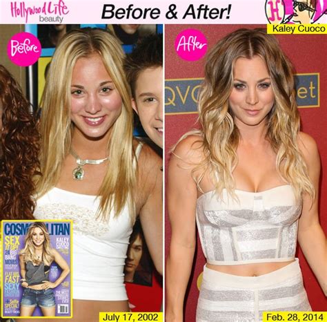 Kaley Cuoco Admits Boob Job At 18 Was ‘Best Decision’ She Ever Made ...