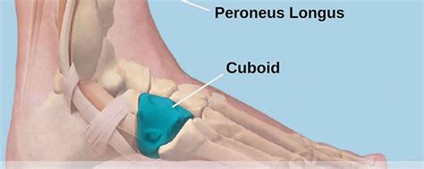 What is Cuboid Syndrome and How does that affect my feet? – Foot Houston