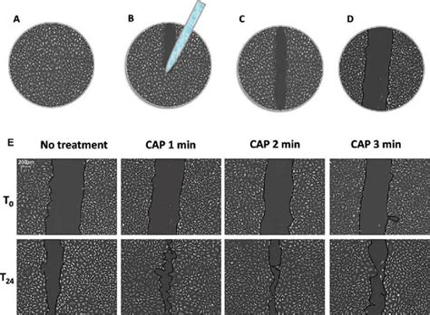 In vitro scratch wound healing assay method. (A) Cells were seeded in a... | Download Scientific ...