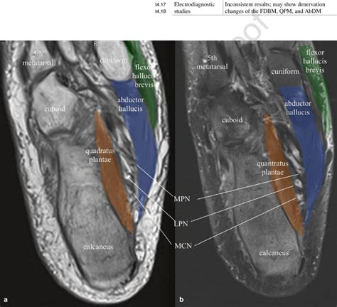 Foot Muscles Mri Anatomy : MRI Ankle Anatomy | Ankle anatomy, Anatomy, Human anatomy : You can ...