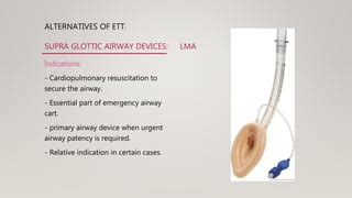 Basic Airway Management | PPT