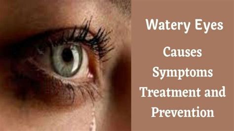 Watery Eyes – Causes, Symptoms, Treatment and Prevention