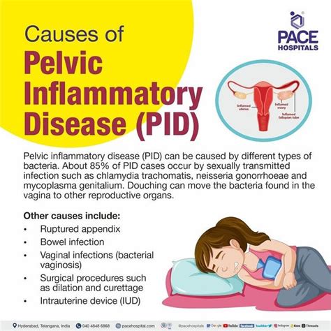 Pelvic Inflammatory Disease In Men