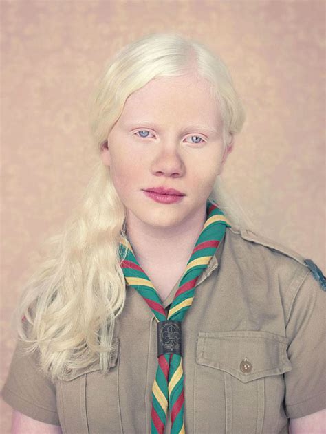 Albinos, A Beautiful Photo Essay of People With Albinism