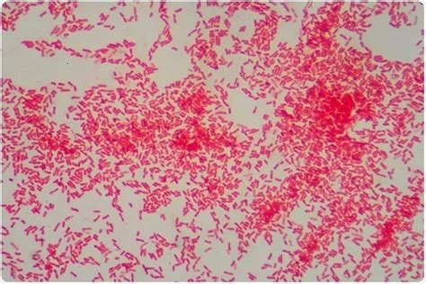 Gram Positive vs Gram Negative Bacteria | ORAPI Asia