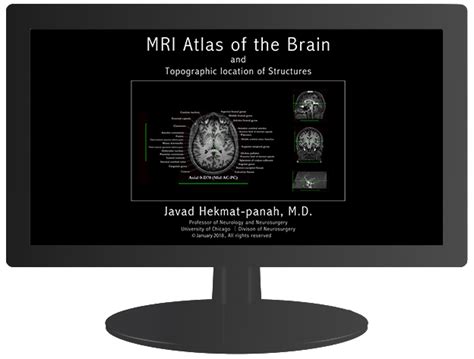 Atlas | JHP MRI Brain Atlas