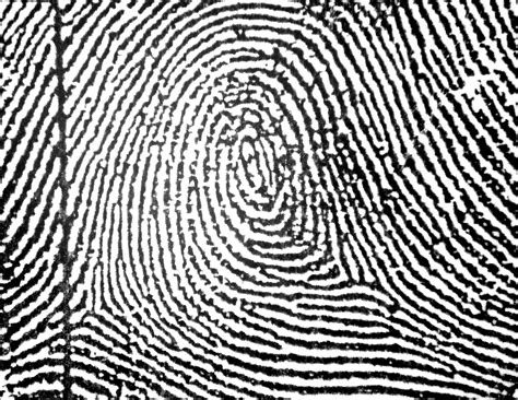 File:Central Pocket Loop Whorl in a right little finger.jpg - Wikimedia Commons