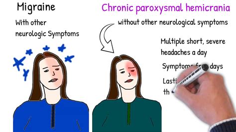 Chronic paroxysmal hemicrania vs Cluster Headache - YouTube