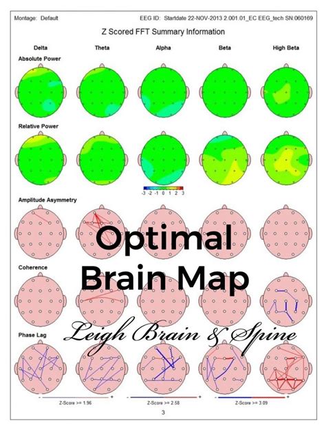 What a "Normal" qEEG Brain Map Looks Like. - Leigh Brain & Spine