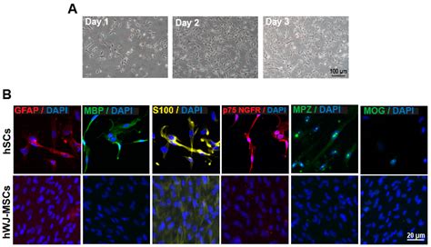 IJERPH | Free Full-Text | Hydroxytyrosol Promotes Proliferation of Human Schwann Cells: An In ...