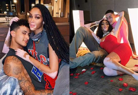 Who is Kyle Kuzma’s Girlfriend, Winnie Harlow?