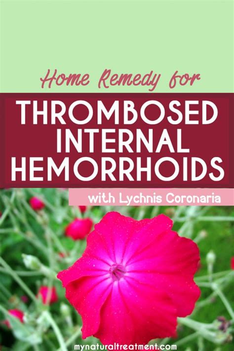 1 Easy Home Remedy for Thrombosed Internal Hemorrhoids