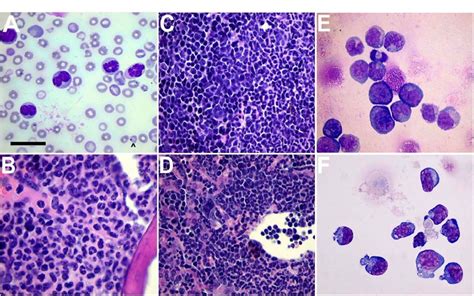 Cold Spring Harbor Laboratory team shows how loss of key protein promotes aggressive form of ...