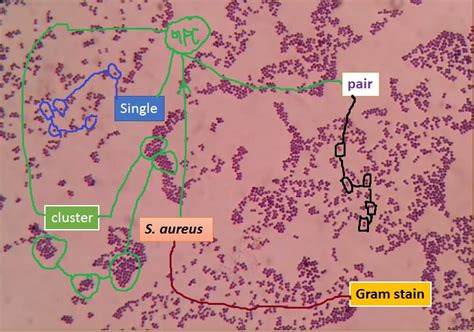 Staphylococcus Epidermidis Negative Stain