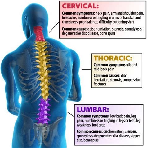 Exercises to assist in alleviating lower back pain. - LMTLSS ...