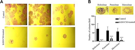 Clonogenicity of MCF7 cells following the treatment with and without ...