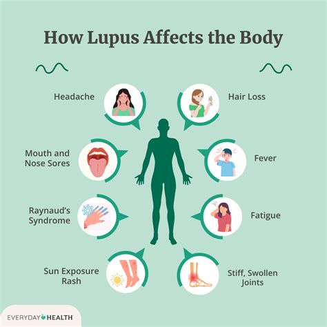 Lupus Symptoms Mouth Ulcers - Infoupdate.org