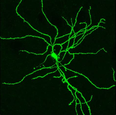 Neurophysiology | ULB Neuroscience Institute