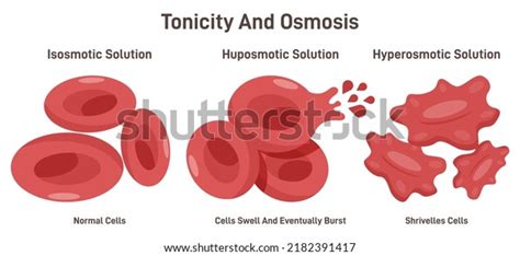 46+ Hypertonic Hypotonic Isotonic Diagram - KaisyKarston