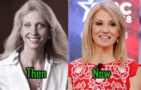 Kellyanne Conway Plastic Surgery: Facelift, Botox, Before-After Photos ...