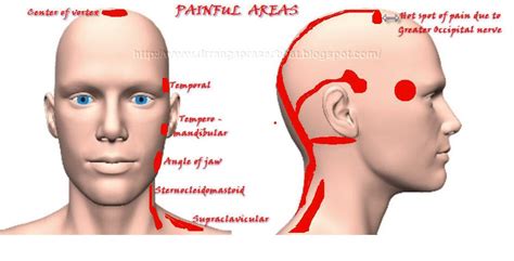 Marma & Ayurveda Chikitsa: Role of posture in the manifestation of ...