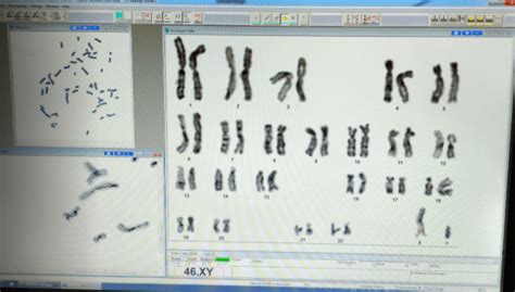 Chromosome nomenclature and G banding » Clinical Laboratory Science