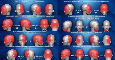 Location of Headache Meaning and Headache Placement Meanings on Headache Charts - Virtual ...