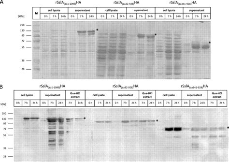 Expression and secretion of recombinant S-layer fusion proteins in B ...