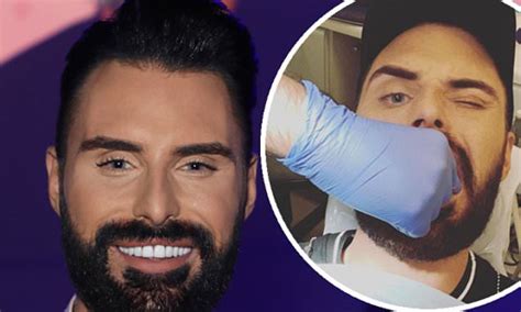 Rylan Clark reveals he's getting new teeth after eight years