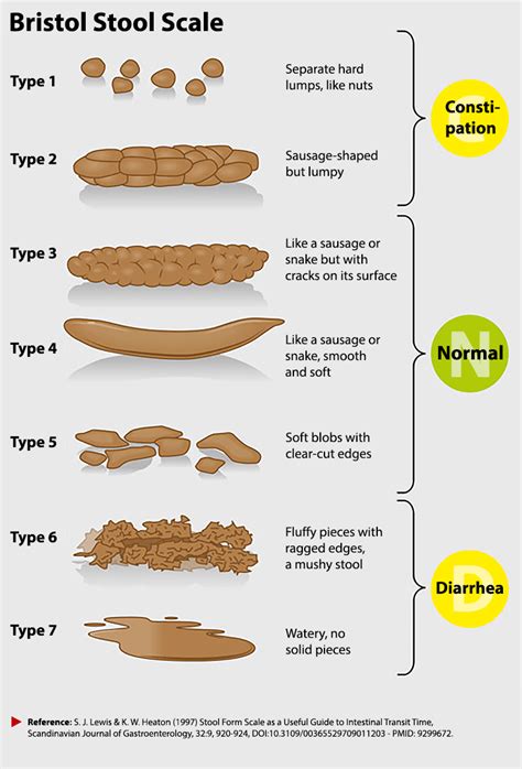 Bristol Stool Chart Tool For Faeces Type Classification Vector Illustration ...