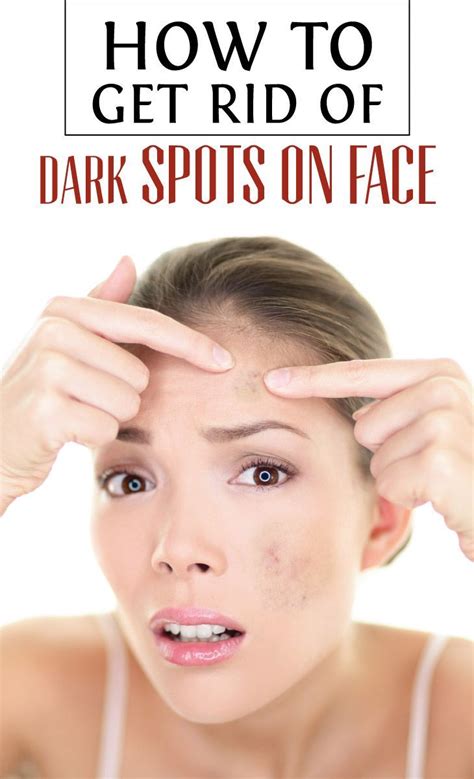 How To Get Rid Of Dark Spots On Face | Dark spots on face, Brown spots ...