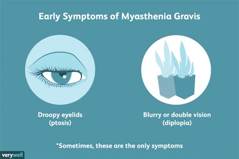 Myasthenia Gravis - 03 Symptoms, Causes & Complications