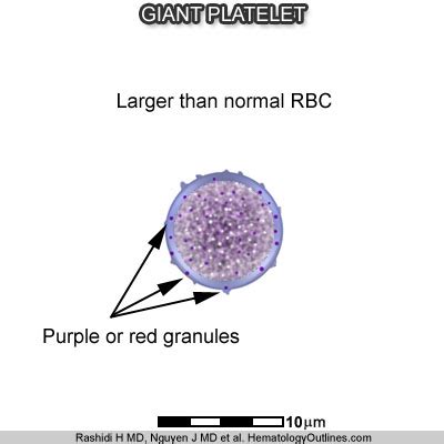 Rare Giant Platelets