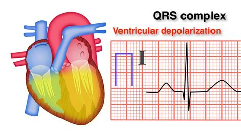 ECG Basics 8/10 - QRS Complex - YouTube