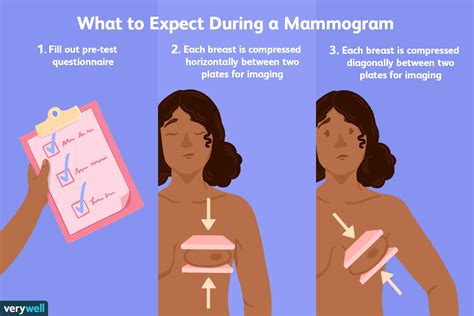 Mammogram: Uses, Side Effects, Procedure, Results