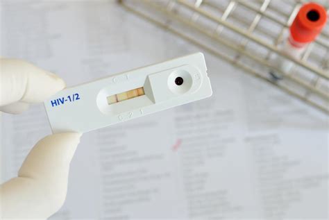 What Is a Surface Antigen? (with pictures)