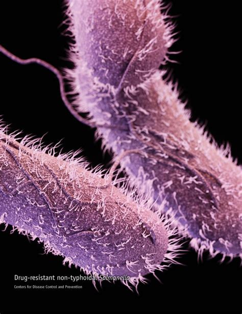 Medical illustration of Salmonella Typhi.