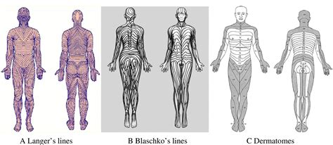 how tension lines form - Google Search