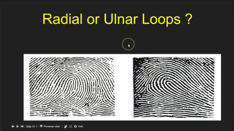 What Is A Ulnar Loop Fingerprint? The 6 Detailed Answer ...