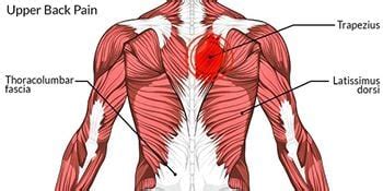 Upper Back Pain Diagram