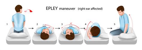 Epley maneuver left ear affected Royalty Free Vector Image