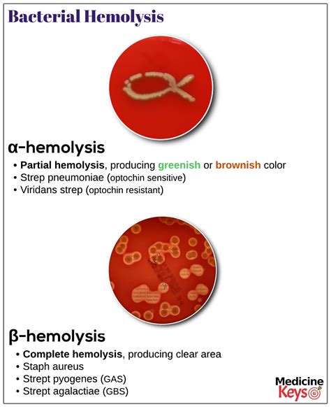 Bacterial hemolysis - Medicine Keys for MRCPs