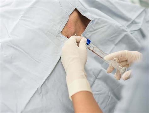 How To Get The Best Results From Epidural Injections - Illinois Pain ...