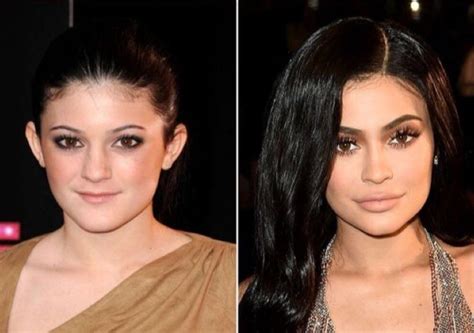 kylie jenner before and after - Recherche Google | Cejas de kylie ...