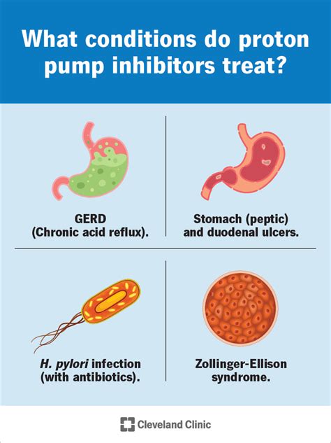 Proton Pump Inhibitors (PPIs): What They Are & Side Effects