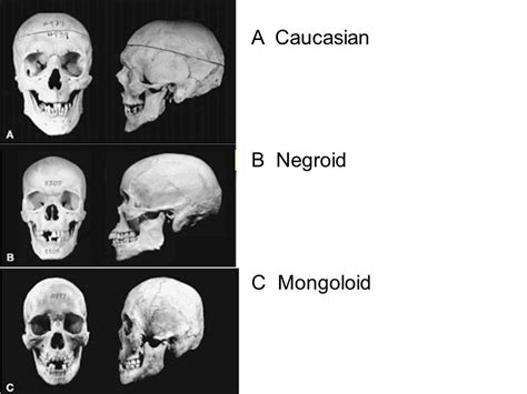 Forensic Anthropology Determining Ancestry from human remains - ppt video online download