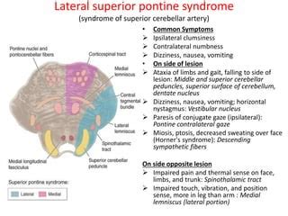 Lateral Pontine Syndrome Mri