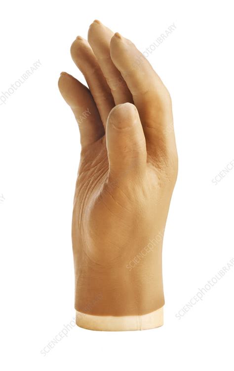 Prosthetic hand - Stock Image - M610/0103 - Science Photo Library